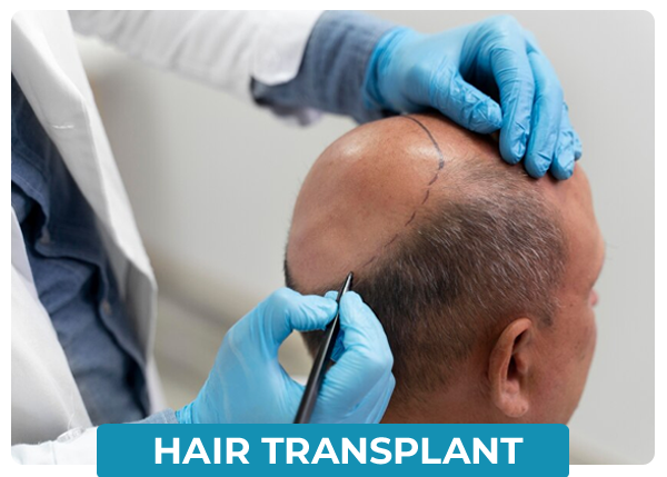 Hair Transplant